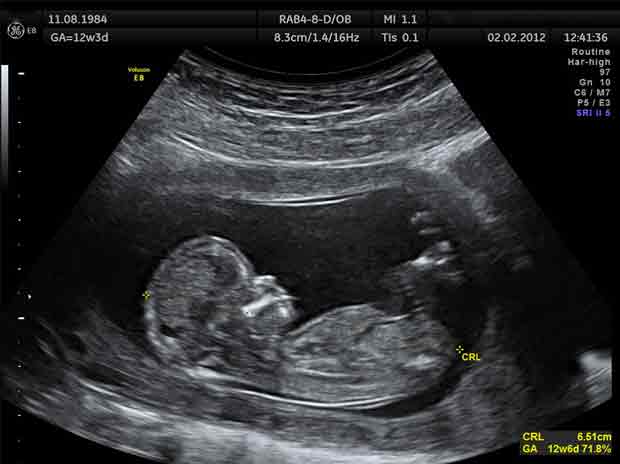 Ultrasound Scanning