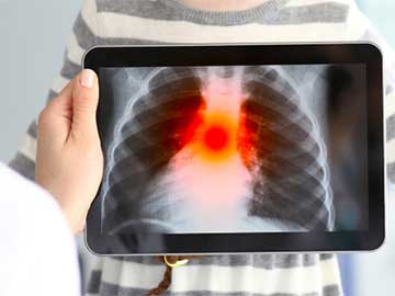Top Pulmonologists in Hyderabad