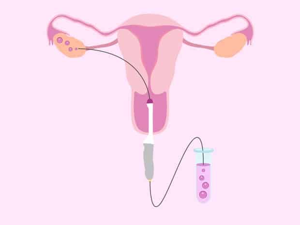 fertility care