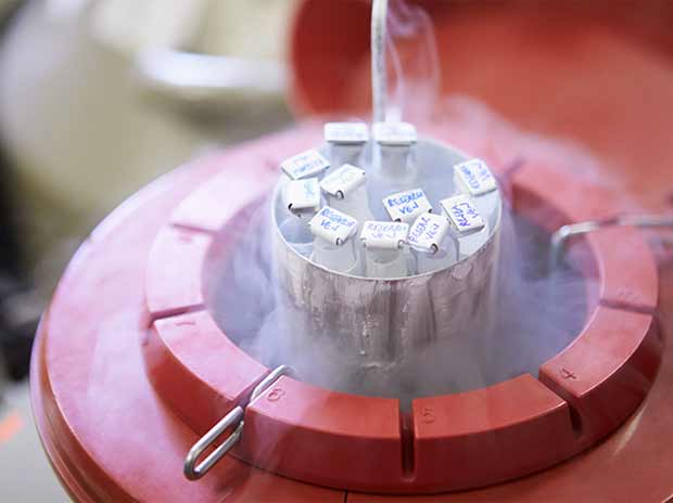 Infertility sperm storage