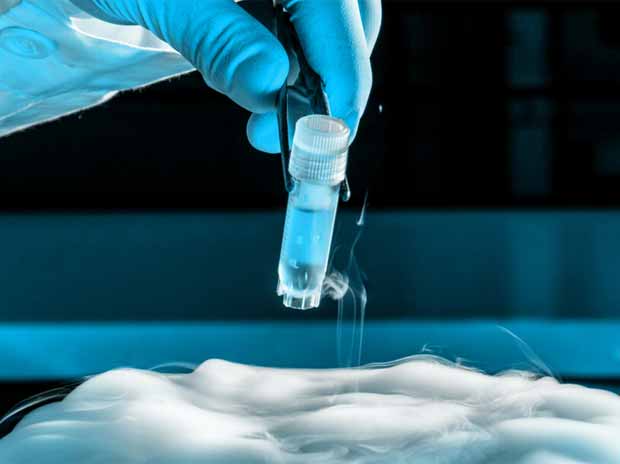 fertility Preservation