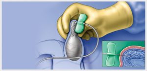 Infertility Specialists In Hyderabad
