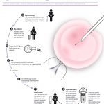 Best Infertility Hospitals In Hyderabad