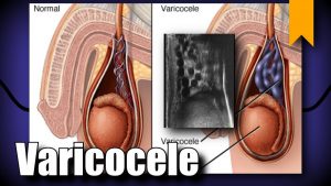 IVF Specialists in Hyderabad