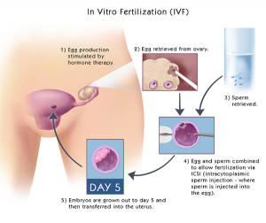 IVF center in Hyderabad