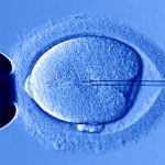 IVF Specialists in Hyderabad